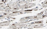 PAB10243 - PPP1R13L