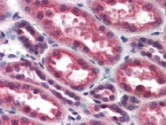 PAB10246 - IKKA