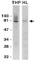 PAB10249 - IRAK1