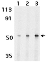 PAB10251 - IRAK4