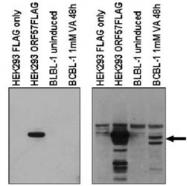PAB10254 - Herpes Virus Type 8 / HHV8
