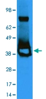 PAB10255 - lacI