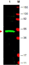 PAB10257 - LDB1