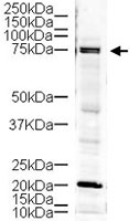 PAB10258 - LIMK1