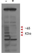 PAB10267 - MLF1IP