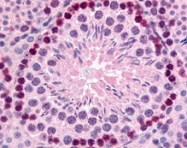 PAB10270 - GLI2