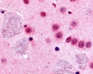 PAB10270 - GLI2