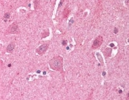 PAB10273 - LDB2