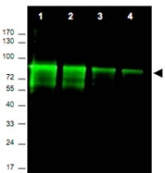 PAB10276 - MRE11