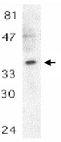 PAB10280 - MYD88