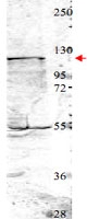 PAB10283 - NEDD4
