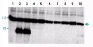 PAB10291 - NOTCH1