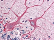 PAB10292 - NOTCH1