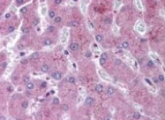 PAB10293 - NOTCH2