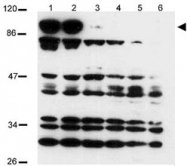 PAB10294 - NOTCH2