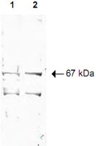 PAB10295 - NRF1