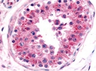 PAB10295 - NRF1