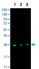 PAB10300 - CDKN1B / KIP1