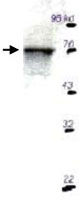 PAB10302 - RPS6KB1 / STK14A