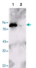 PAB10303 - RPS6KA1