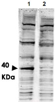 PAB10304 - PACRG