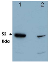 PAB10308 - PDCD4