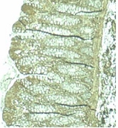 PAB10308 - PDCD4