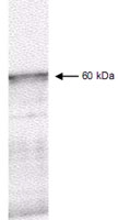 PAB10309 - PDPK1