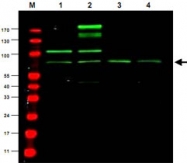 PAB10322 - RREB1