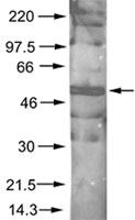 PAB10323 - AKT1 / PKB