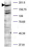 PAB10327 - Huntingtin