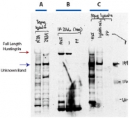 PAB10327 - Huntingtin