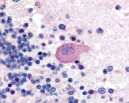 PAB10327 - Huntingtin