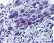 PAB10333 - MLF1IP