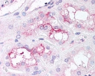 PAB10335 - mTOR / FRAP1