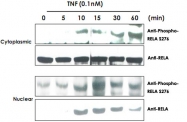 PAB10336 - RELA / NF-kB p65