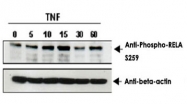 PAB10337 - RELA / NF-kB p65