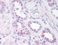 PAB10338 - RELA / NF-kB p65