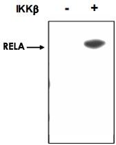 PAB10338 - RELA / NF-kB p65
