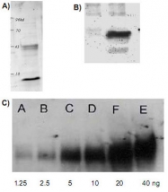 PAB10348 - Acetylated Lysine