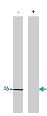 PAB10354 - Protein phosphatase 1A / PPM1A