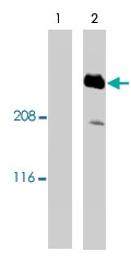 PAB10358 - AKAP12 / SSeCKS