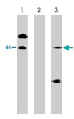 PAB10360 - EDG1 / S1P1
