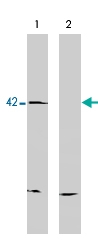PAB10361 - EDG8 / S1P5
