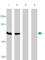 PAB10362 - BAG4