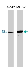 PAB10368 - PPP5C