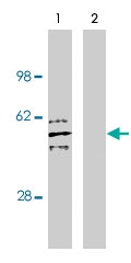 PAB10380 - SGMS2