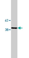 PAB10381 - SAMD8 / SMSr
