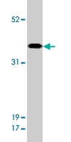 PAB10383 - SIAH1