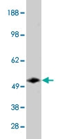 PAB10403 - SMPD3
